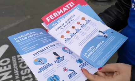 "La prevenzione al centro" contro il melanoma