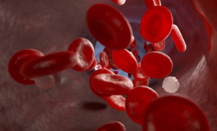 Beta-Talassemia, nuova molecola riduce la necessità di sangue